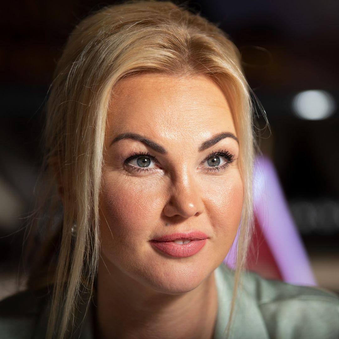 Камалия впервые честно рассказала о "пластике" лица
